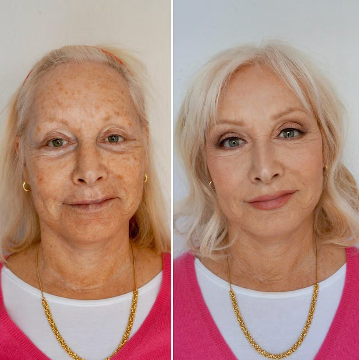Vitaj+™ Advanced Multi Collagen Peptides