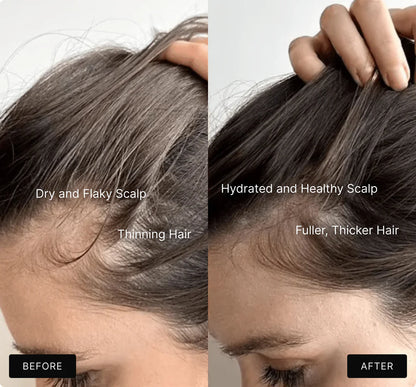 RevivaScalp Massage  Relax